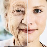 Causes of premature aging skin